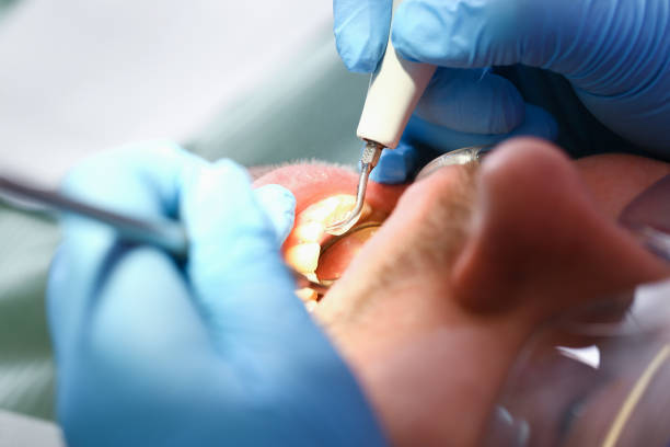 Best Weekend Emergency Dentist in Lebanon, IN